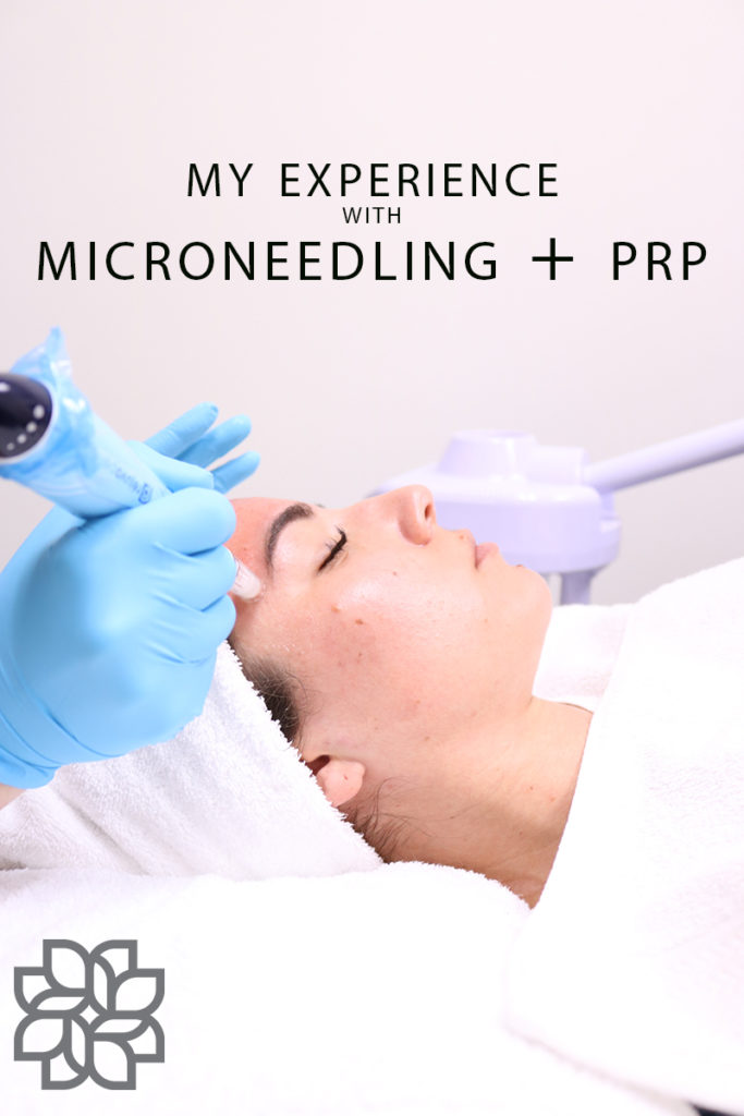 Image says, " my experience with microneedling and PRP" with Lauryn Hock's face in the background as she enjoys a spa experience.