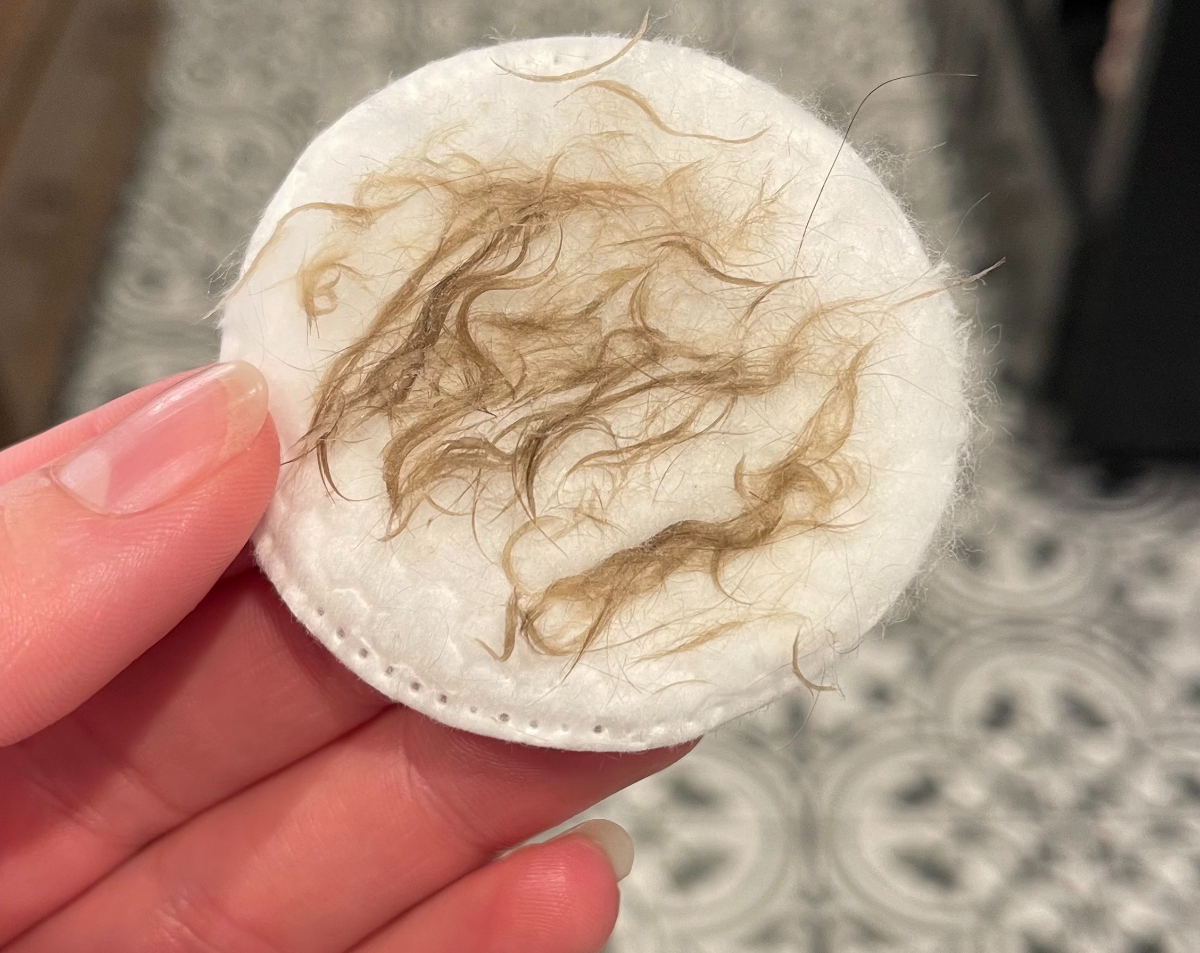 hair that came off from dermaplaning